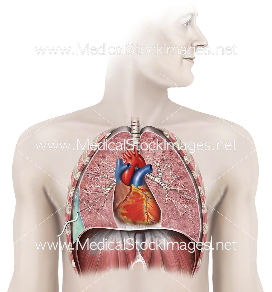 Anatomy of Chest with Drain in place – Medical Stock Images Company