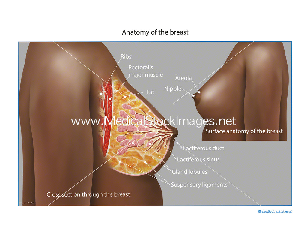 Front view of female breast anatomy with a lump present, Stock Photo,  Picture And Rights Managed Image. Pic. SJB-4378-3041